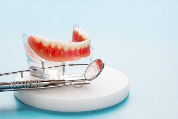 Full Mouth Reconstruction in Dallas, TX